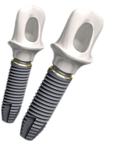 implant-nobel.png